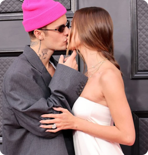 لحظات تقبيل المشاهير